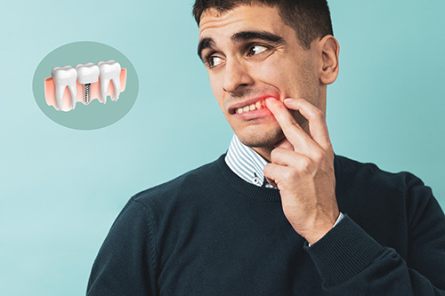 Сильная боль у мужчины из-за отторжения зубного импланта